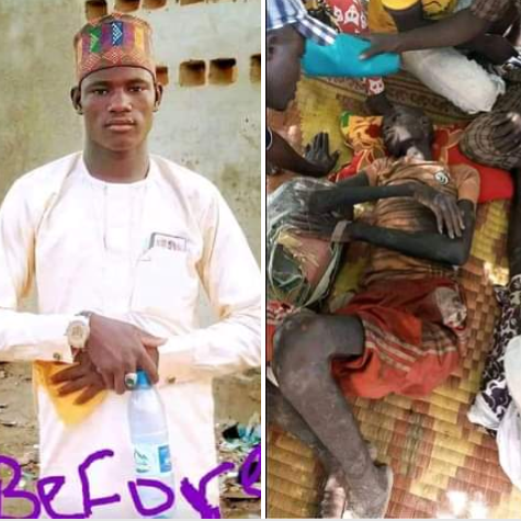Before and after photos of Zamfara man who regained freedom after 7 months in bandits