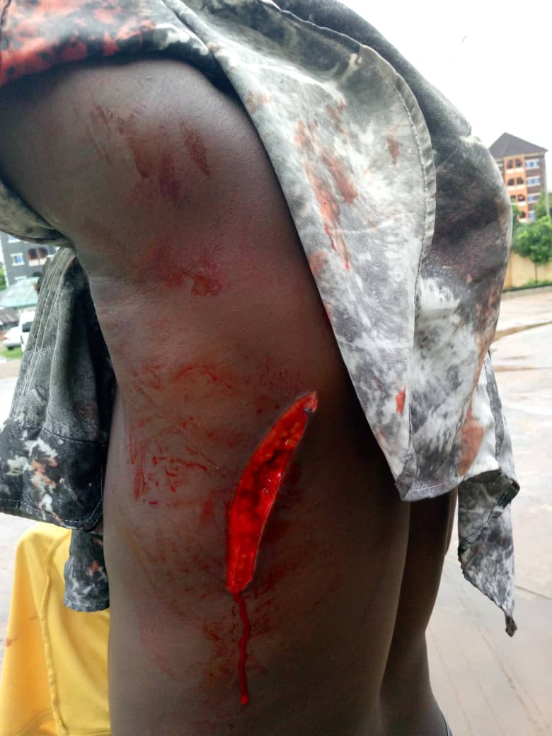 "What is the hope of a common man in this nation? - Onitsha trader laments as he accuses police of releasing suspect who stabbed him after allegedly collecting bribe