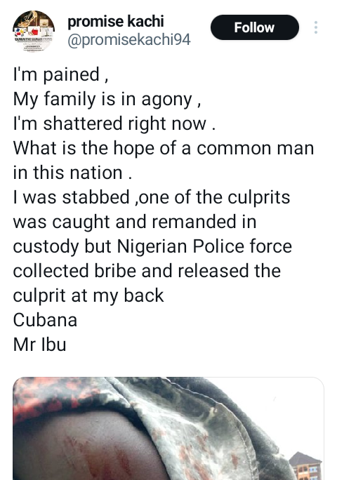 "What is the hope of a common man in this nation? - Onitsha trader laments as he accuses police of releasing suspect who stabbed him after allegedly collecting bribe